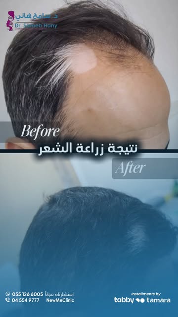 ⁨	📞 استشارتك علينا
📍 نيو مي كلينك – مدينة دبي الطبية
☎️ للحجز والتواصل: 0551266005⁩