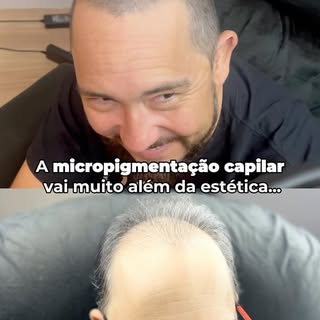 A autoestima de um homem é significativamente influenciada por sua relação com o cabelo.

🧑🏼‍🦲Se 