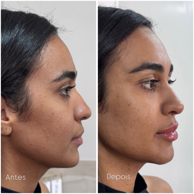 Harmonização facial não é sobre mudar o rosto. É sobre entender cada detalhe e valorizar o que já é 