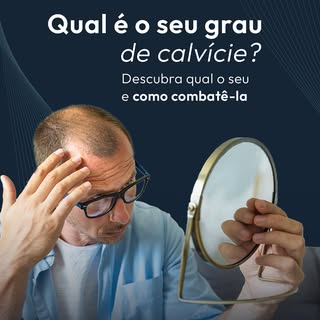 Você sabe qual é o seu grau de calvície? Deslize os cards e descubra.

A Escala Norwood-Hamilton mos