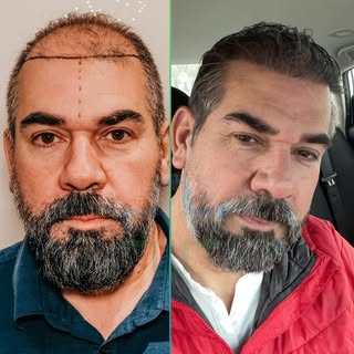 Que transformação! ⚜️
Oferecemos a você um serviço impecável com nossos especialistas experientes em