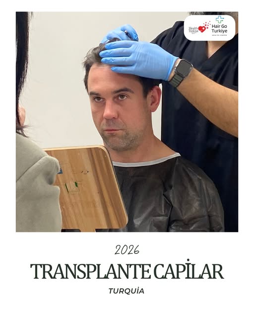 🇹🇷 O transplante capilar na Turquia é uma das opções mais procuradas por pacientes que desejam um 