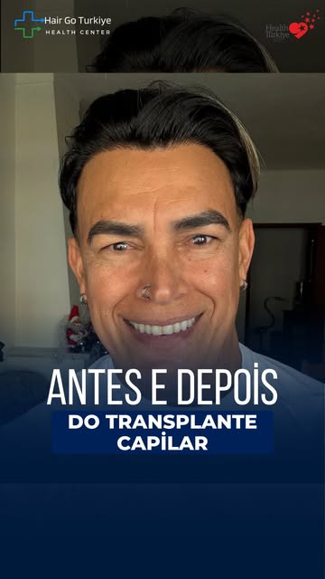 “Você realmente precisa disso?”

Essa é uma pergunta que muitas pessoas ouvem quando decidem pesquis