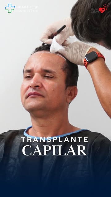 Está pensando em dar um novo passo no combate à queda de cabelo? 

O transplante capilar na Turquia 