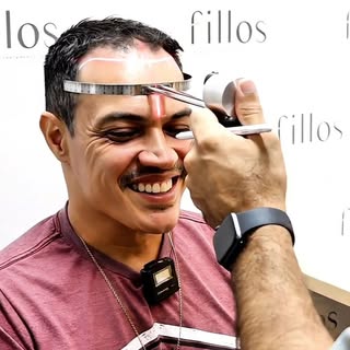 Hoje iremos responder com um vídeo uma curiosidade de muitas pessoas: como é o pré transplante capil