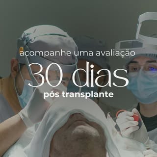 O período de 30 dias pós-transplante capilar é um momento crucial na recuperação e no início do cres