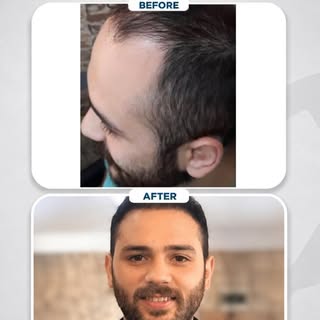 A closer look at the transformation.

This Before & After reflects the result of a personalized hair