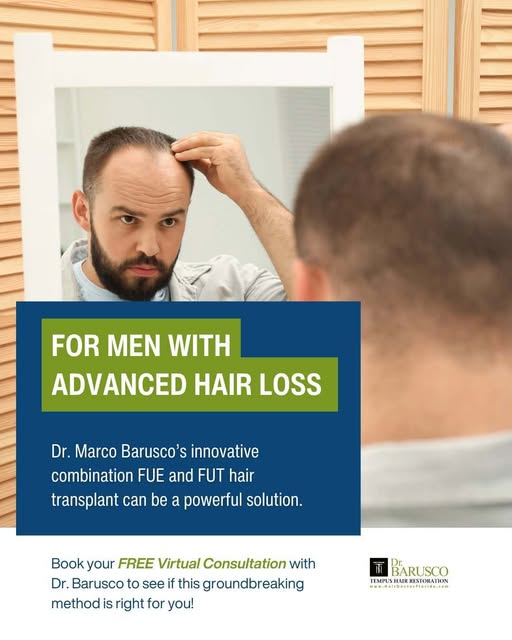 Do you have large bald areas of scalp and wonder if it’s too late for a #HairTransplant? It may stil