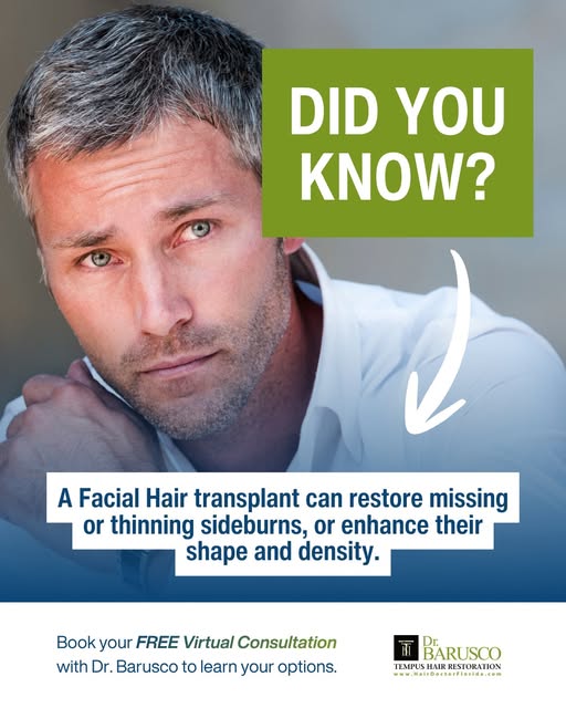 Did you know? A #FacialHair transplant can restore missing or thinning sideburns, or enhance their s