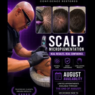 August Availability ✨

A natural-looking hairline can change more than your appearance — it can chan