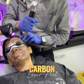 Carbon Laser Peel: The Glow Your Skin Will Love ✨ #carbonlaser #glowingskin | Want fresher, brighter