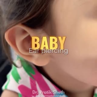 Baby Ear Piercing: Safe, Gentle & Expert Care 👶✨ #earpiercing #babycare | Tiny ears deserve gentle 