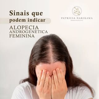 A alopecia androgenética feminina, ou calvície feminina, é uma forma de queda de cabelos geneticamen