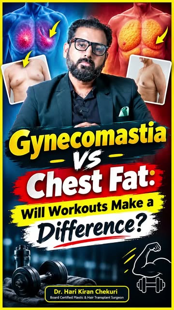💪 Gynecomastia vs Chest Fat — Workouts తో తగ్గుతుందా?

చెస్ట్‌లో కొవ్వు ఉందని అనిపిస్తే అది కేవలం C
