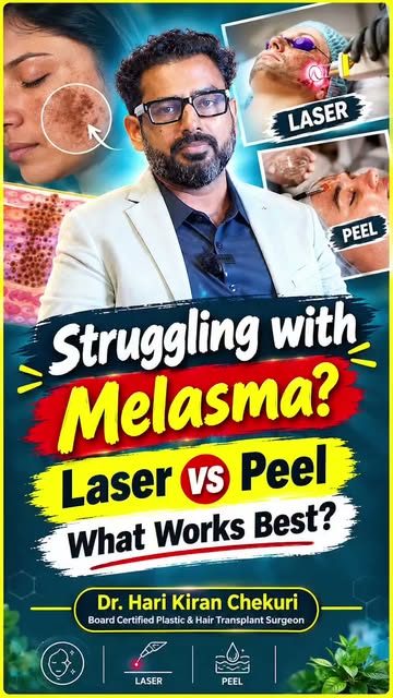 Melasma Treatment: Laser vs Chemical Peel — Which Is Better? 

Struggling with stubborn pigmentation