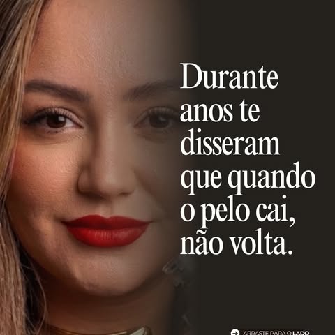 Crescimento Natural e Recuperação Fios sem cirurgia e sem pigmento . 
Essa tecnologia avançada é o s