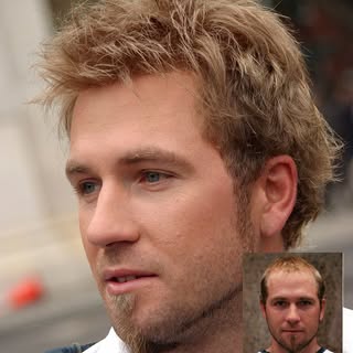 Men's hair replacements are a non-surgical solution that gives immediate results. If you are tired o