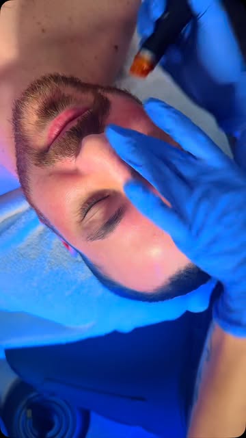 ✨ Your glow starts with a deep clean ✨

HydraFacial is one of my favorite treatments for giving the 