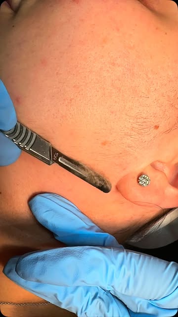 ✨ DERMAPLANING IN 30 SECONDS ✨

A quick look at one of my favorite ways to get that smooth, fresh-sk