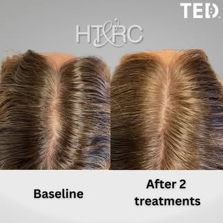 ✨ The results are in, and they’re AMAZING! 🌟 

Patients are absolutely loving their transformations