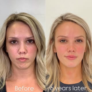 Great results don’t come from a single treatment, they come from having a long term plan. And gettin