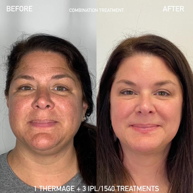 This result is a great example of why treatment plans are not always one-size-fits-all.

For this pa