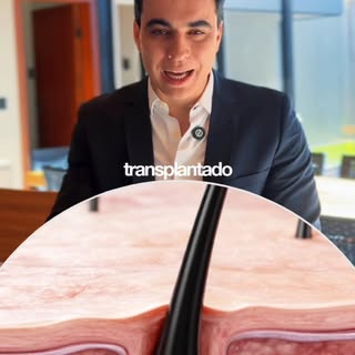Você pensa em fazer um transplante capilar? 💭

No vídeo acima, explico de forma simples como aconte