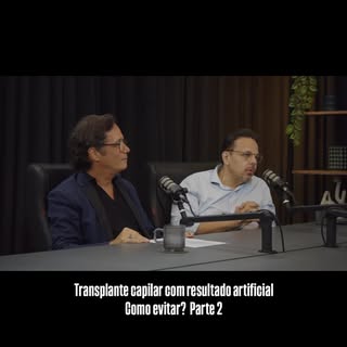 • Resultado artificial no transplante capilar. Baixa densidade folicular com implantação inadequada 