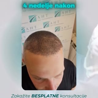 Od preciznog planiranja do prirodnog rezultata.

Na prvom koraku pažljivo se definiše nova linija ko