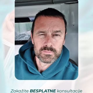 Rezultat koji izgleda prirodno – danas, sutra i godinama kasnije.

Transplantacija kose nije samo pr