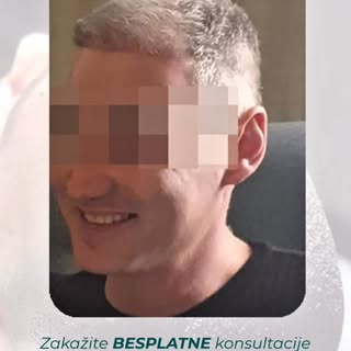 Od prvog pregleda do rezultata koji izgleda prirodno.

Transplantacija kose nije samo estetska proce
