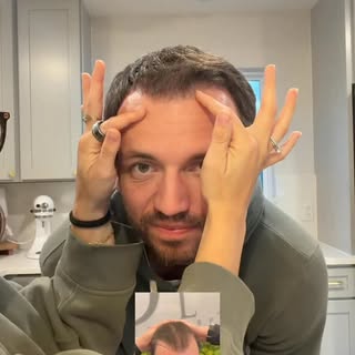 Who’s this hottie?? 🤩🤪

#mdhairlabs #hairtransplant #northwestarkansas #update