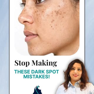 ✨ Dark spots don’t disappear with guesswork.

The moment we notice pigmentation, many of us rush to 