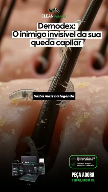 CASPA, COCEIRA NO COURO CABELUDO E QUEDA DE CABELO? 👀👀

Você já imaginou que existe uma vida micro