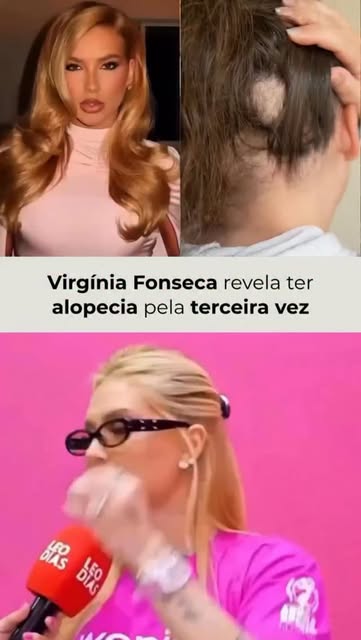 O relato da Virgínia fez muita gente se identificar. Mas existe um detalhe importante: nem toda alop