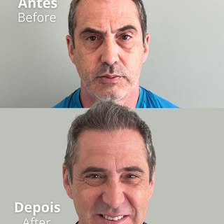 A mudança não está apenas nos fios.

Quando o cabelo volta a ocupar seu espaço de forma natural, a e
