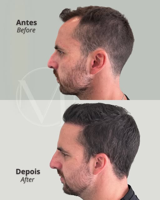 Dr. Décio Montresor — CRM 129016/SP

Publicação acadêmica conforme despacho 143/2019 CFM, art. 75, a