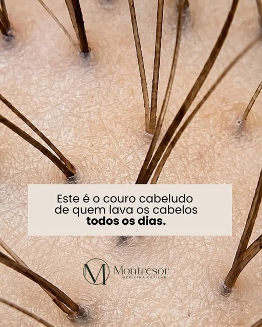 Seu couro cabeludo também responde aos seus hábitos. 

A lavagem  frequente dos seus cabelos é essen