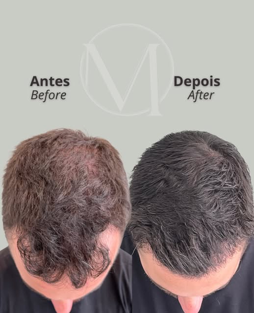 Dr. Décio Montresor — CRM 129016/SP

Publicação acadêmica conforme despacho 143/2019 CFM, art. 75, a
