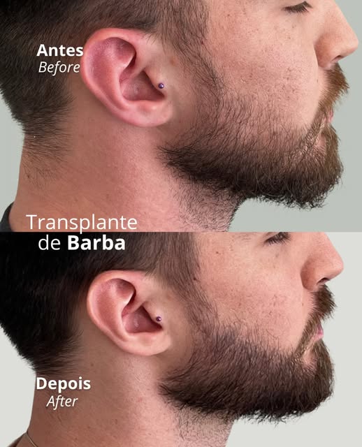 Dr. Décio Montresor — CRM 129016/SP

Publicação acadêmica conforme despacho 143/2019 CFM, art. 75, a
