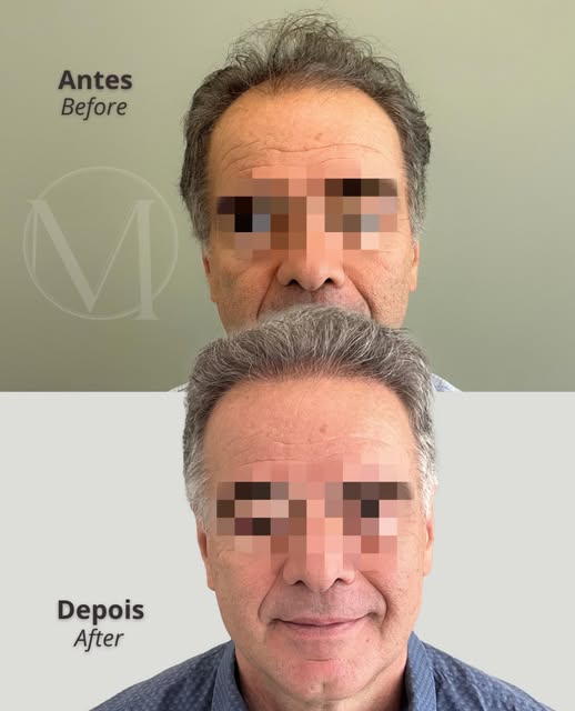 Dr. Décio Montresor — CRM 129016/SP

Publicação acadêmica conforme despacho 143/2019 CFM, art. 75, a