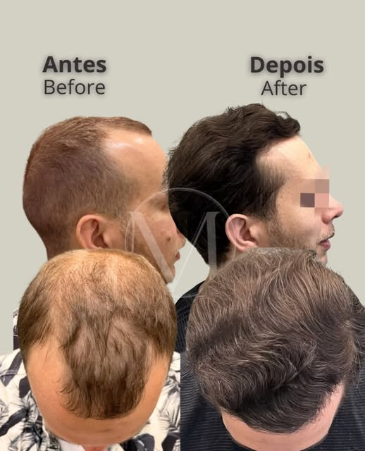 Dr. Décio Montresor — CRM 129016/SP

Publicação acadêmica conforme despacho 143/2019 CFM, art. 75, a