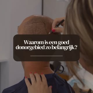 Het donorgebied speelt een belangrijke rol bij een haartransplantatie. Niet alleen het gebied waar m