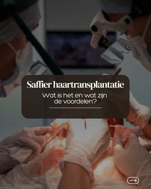 Je leest online veel over FUE en saffier FUE. Maar wat is nu precies het verschil?

Bij een FUE-haar