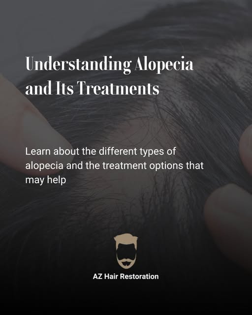Alopecia is not a single condition but a group of different types of hair loss, each with its own ca