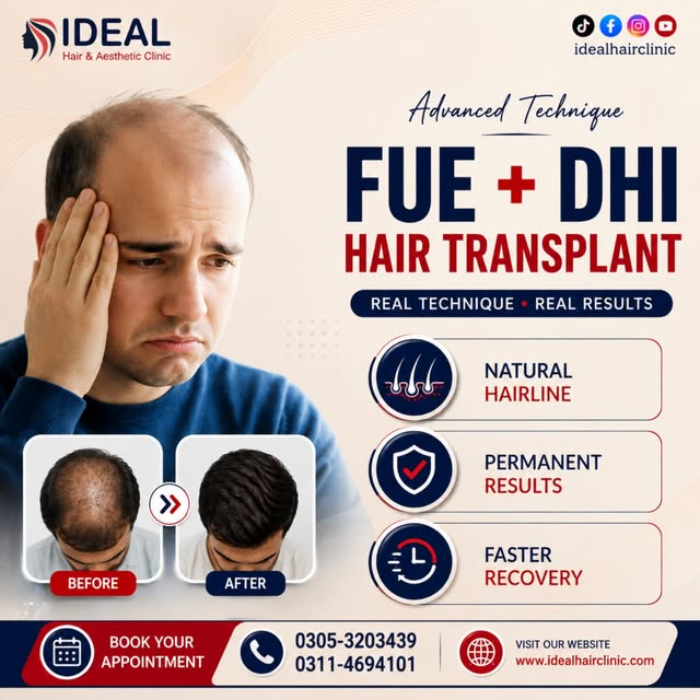 👉 Say goodbye to hair loss and hello to a natural, permanent hairline. 🌟

Why Choose FUE + DHI?

✅