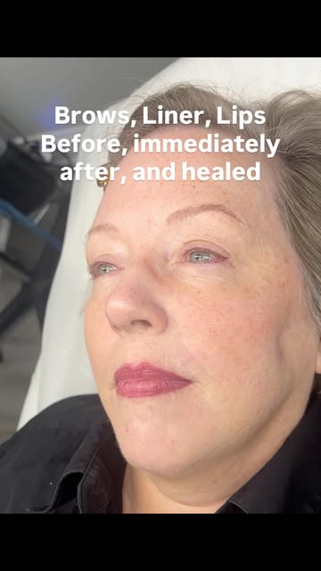 ✨ THE FULL TRANSFORMATION ✨

From before → immediately after → beautifully healed 

This client rece