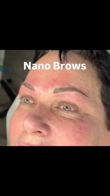 ✨ NANO BROWS — Before & After ✨
Beautifully defined brows created with ultra-fine, hair-like strokes