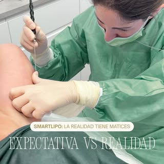 Es muy común pensar que tratamientos como Smartlipo eliminan toda la grasa y tensan la piel por comp