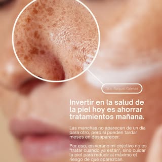 ☀️ En verano, mi objetivo no es corregir manchas. Es ayudar a prevenir que aparezcan.

Como médica e